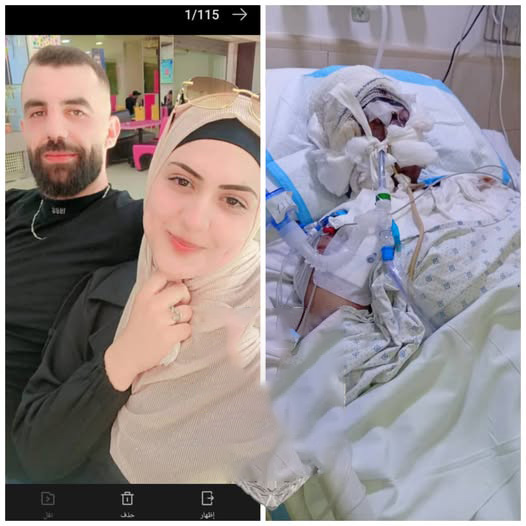 رمى زوجته بالزيت المغلي... حليمة تصارع الموت في المستشفى! (صورة داخل الخبر)