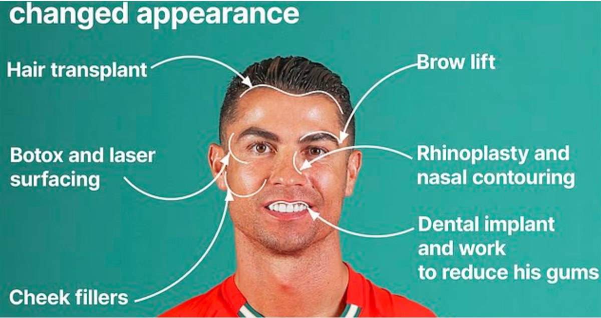 جراح تجميل يكشف أسرار تغير ملامح رونالدو خلال 20 عاما (صورة)