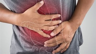 بكتيريا معوية تُتهم في ارتفاع سرطان القولون لدى الشباب: دراسة تكشف العلاقة المبكرة