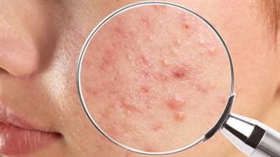 نتائجها مفاجئة.. دراسة تكشف علاقة 