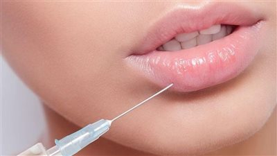 عادة شائعة تسبب تشوهات مرعبة في الوجه بعد حقن الشفاه... والخبراء يحذّرون!