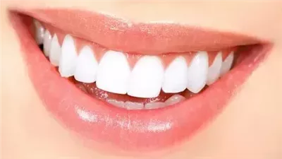 حتى بعد التبييض... هذه الأطعمة تصفر أسنانك!