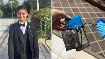 نجاة الطفل مهدي هاشم ( 9 سنوات ) من انفجار هاتفه الخليوي!