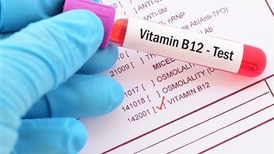أعراض داخل الفم قد تكون مؤشراً واضحاً على نقص فيتامين B12