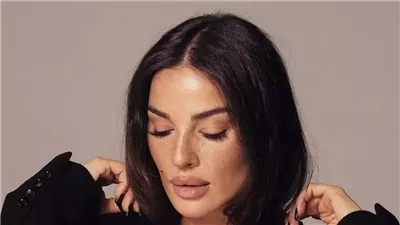 بصيحة النمش.. نادين نسيب نجيم تضجّ جمالاً
