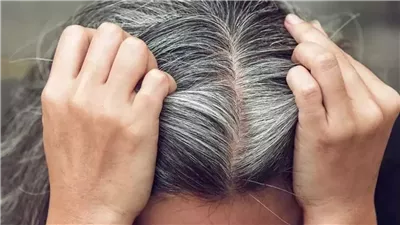 هل من علاقة بين الشيب والتوتر النفسي.. العلم يكشف