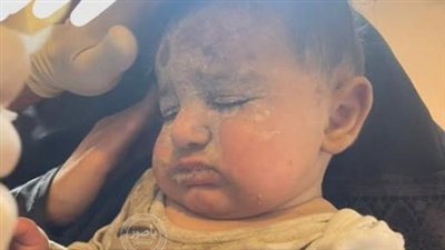 انقاذ طفل من تحت الأنقاض في بلدة طيرفلسيه