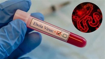 إيبولا يفاقم القلق في الكونغو.. أكثر من 200 وفاة محتملة